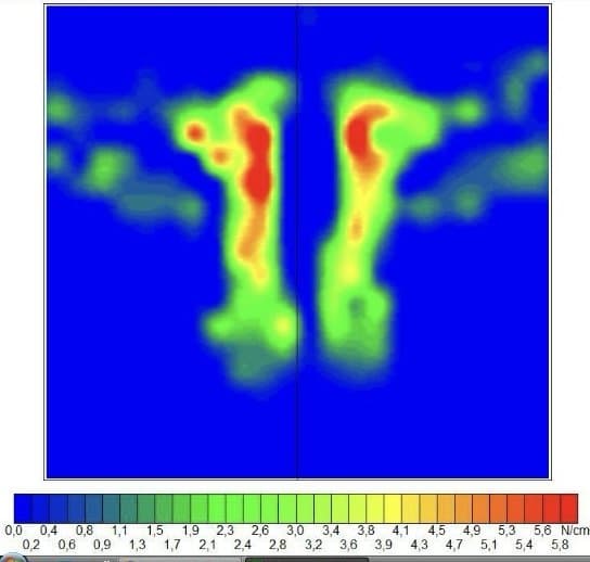 Druckbild in der Analysesoftware: zwei längliche Druckzonen links und rechts der Wirbelsäule mit roten Druckspitzen, darunter die Farbskala von 0 bis 5,8 N/cm²